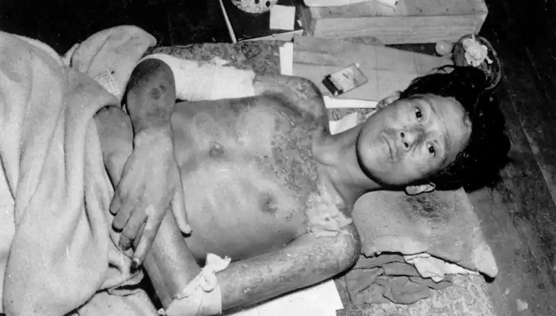 80 Yıl Sonra Nagasaki'den Gelen Korkutucu Çağrı: Nükleer Tehdit Artıyor
